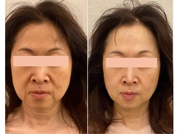 ドクターボディクリスタル(Dr.Body Crystal)/50代