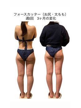 ビーアイリー(Be irie)/痩身エステ フォースカッター