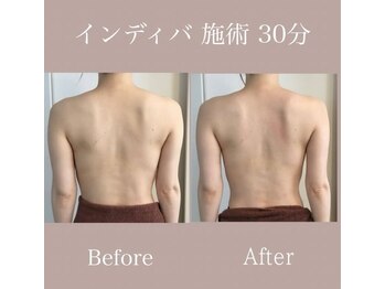 カノン(Kanon.)/インディバボディ