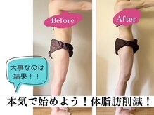 ヨサパーク ククナ(YOSA PARK kukuna)