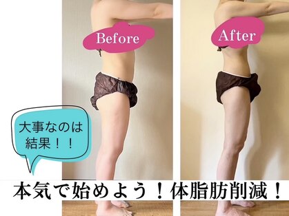 ヨサパーク ククナ(YOSA PARK kukuna)の写真