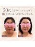 【徹底小顔+プラズマリフトアップ】オールハンド小顔+プラズマシャワー90分