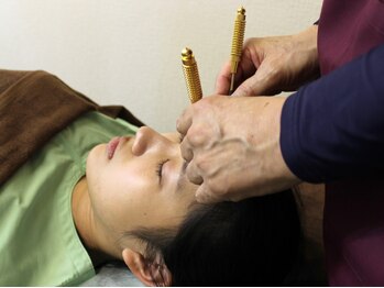 いなほ はりきゅう整骨院 東新宿/美容鍼施術/手順10