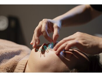 カラダキュア 東京銀座/真皮鍼