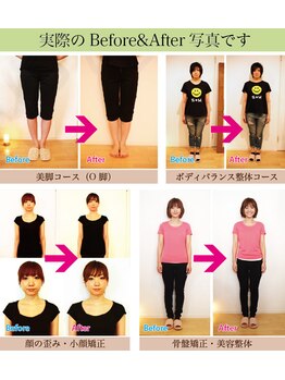 代官山コンディショニング/施術例【マッサージ/肩こり】