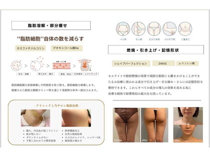 ルナグランデ 心斎橋店(Luna grande.)の写真