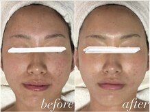 フォー(For...)/ブライダル美肌|クリスティーナ