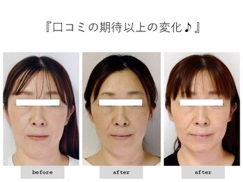 エピファニー(Epiphany)/40代　寝てしまうほど気持ちいい