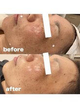 エアリアル 八女店/透明感のある素肌へ。