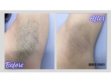 リボーン(Re bone)/丁寧な施術★