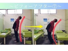 ケアるら整骨院 富里院/ビフォーアフター