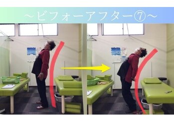 ケアるら整骨院 富里院/ビフォーアフター