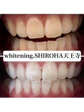 シロハ(SHIROHA)/セルフホワイトニング/天王寺