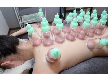 【肩こり・腰痛改善】深層筋整体　深もみサロン柚花/カッピング（吸い玉療法）