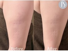 リアンアンドミー(Lien&me)/施術写真