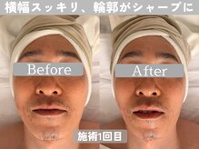 ミピマム 町田店/男性からも支持を得ているサロン