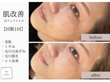 サロン ド パーフェクション(Salon de Perfection)/ブラックピール