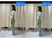 悠然堂整骨院 上牧院/