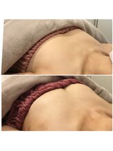 サチ(Sachi)/お肉がなくても大丈夫ですか？