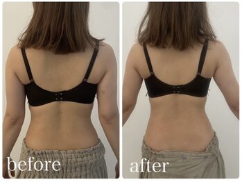 美人バスト 川崎店/【痩身・ダイエット】 腰回り