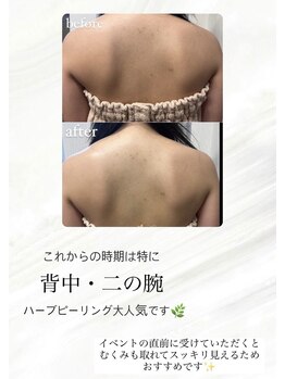 メリー 大和八木店(merry)/夏の時期や結婚式前に大人気♪