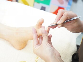 ベネシュ 広島比治山店(BENESU)の写真/【広島希少★ガラスチップで巻き爪ケア】痛みが少ない★巻き爪ケア×べネシュ靴でまっすぐ綺麗な爪に♪