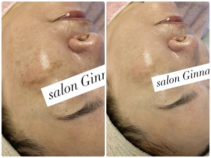 ジーナ(Ginna)の写真