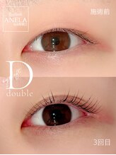 アネラ 仙台駅東口店(ANELA)/ダブルアイリフト