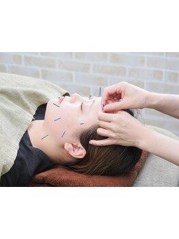 小顔になりたい