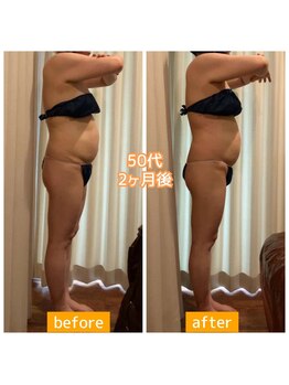 キュール(KuhL)/50代痩身ビフォーアフター☆