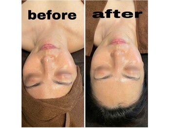 ブルーム(BLOOM)/REVI陶肌トリートメント