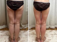 ヨサパーク ホロムア 梅屋敷(YOSA PARK Holomua)の雰囲気（結果重視◎ぽっこりお腹、下半身痩せ、二の腕、お任せ下さい♪）