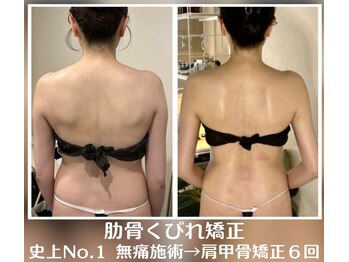 ソウ バイ ソウ(So by 蒼)/激変6回!ブライダルエステ整体