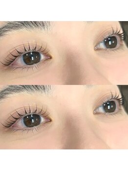 まつげのお悩み解決サロン