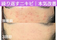 おうちサロン ミキ