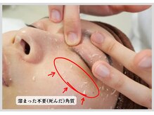 リノミノ(lino'mino)の雰囲気（加工なし【ピーリング】で肌の内側から改善◆一生モノの肌質改善）