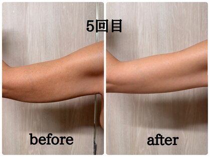 バービーグロウ 恵比寿(Barbie Glow)の写真