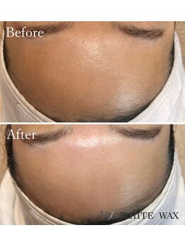 ホワイトワックス 京都四条烏丸(WHITE WAX)/施術1回でこのトーンUP↑