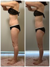 ジェニー(JENNI)/痩身