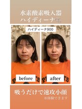 ヨサパーク カルム(YOSA PARK)/ハイディーナ900 Before、after