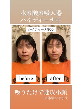 ヨサパーク カルム(YOSA PARK)/ハイディーナ900 Before、after