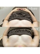 エヌ(N)/バストアップが驚きの効果を発揮