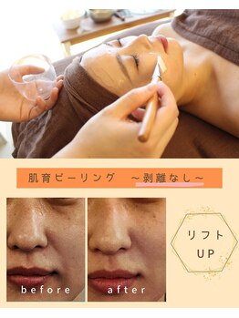 ホウレイ線・たるみ改善！予防ケア