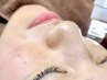 【美白×毛穴開きケアコース】超音波毛穴洗浄×ビタミンC美容液導入×パック