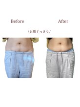 整体院トトノエル 西川原院/Before→After 