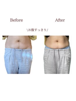 整体院トトノエル 西川原院/Before→After