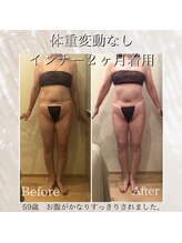 ムーン(MOON)/美ボディ下着ビフォア→アフター