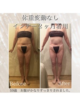 ムーン(MOON)/美ボディ下着ビフォア→アフター