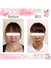 ドロップ(Drop)/顔幅ってこんなに変わるの？！