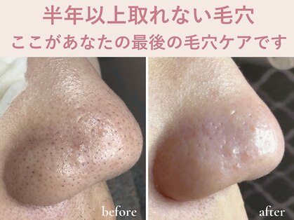 エアル(earu.)の写真